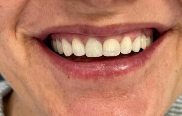 Odontoiatria estetica