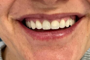 Odontoiatria estetica