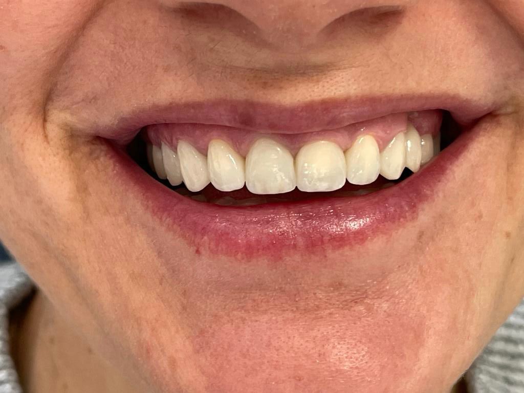 Odontoiatria estetica